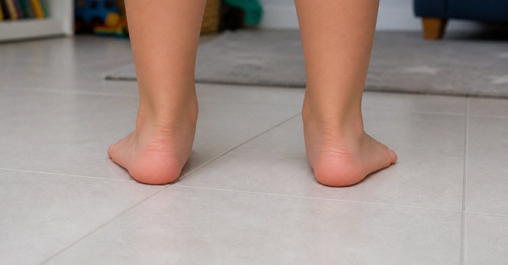 Pé chato em criança: quando é normal e quando precisa de avaliação
